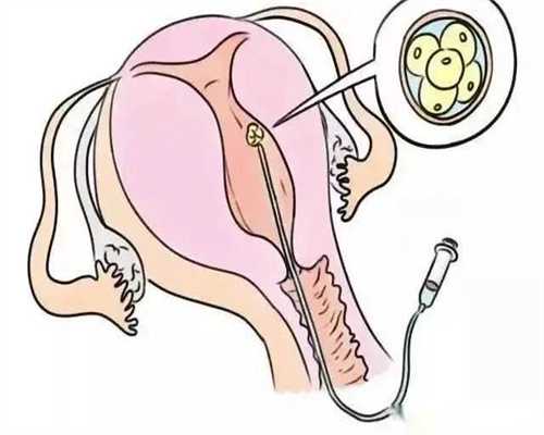 网上说男性y精子比x精子生命力短是真的吗？