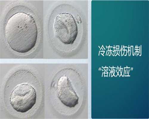 畸形精子类别多，简述不同形态的精子对怀孕的影响